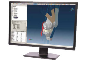 Abaqus膝蓋模擬器圖片